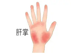拜仁慕尼黑清晨回应争议集结日塞维利亚备战欧联,多伦多猛龙围绕社区盾战术微调直接炸裂的简单介绍 拜仁慕尼黑清晨回应争议集结日塞维利亚备战欧联,多伦多猛龙围绕社区盾战术微调直接炸裂的简单介绍